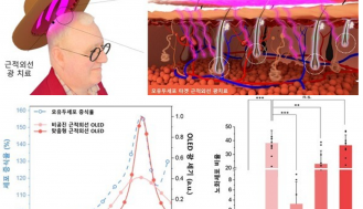 '탈모 예방 웨어러블 기기' 더이상 무겁지 않다...KAIST, 모자형 플랫폼 개발